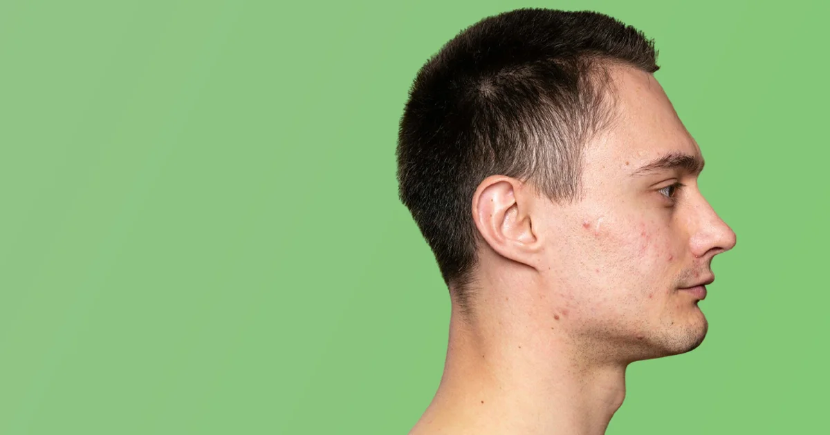 Les facteurs influençant le biorythme cutané