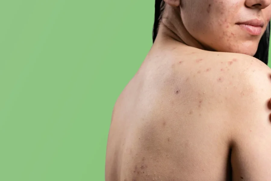 Le Biorythme de la Peau