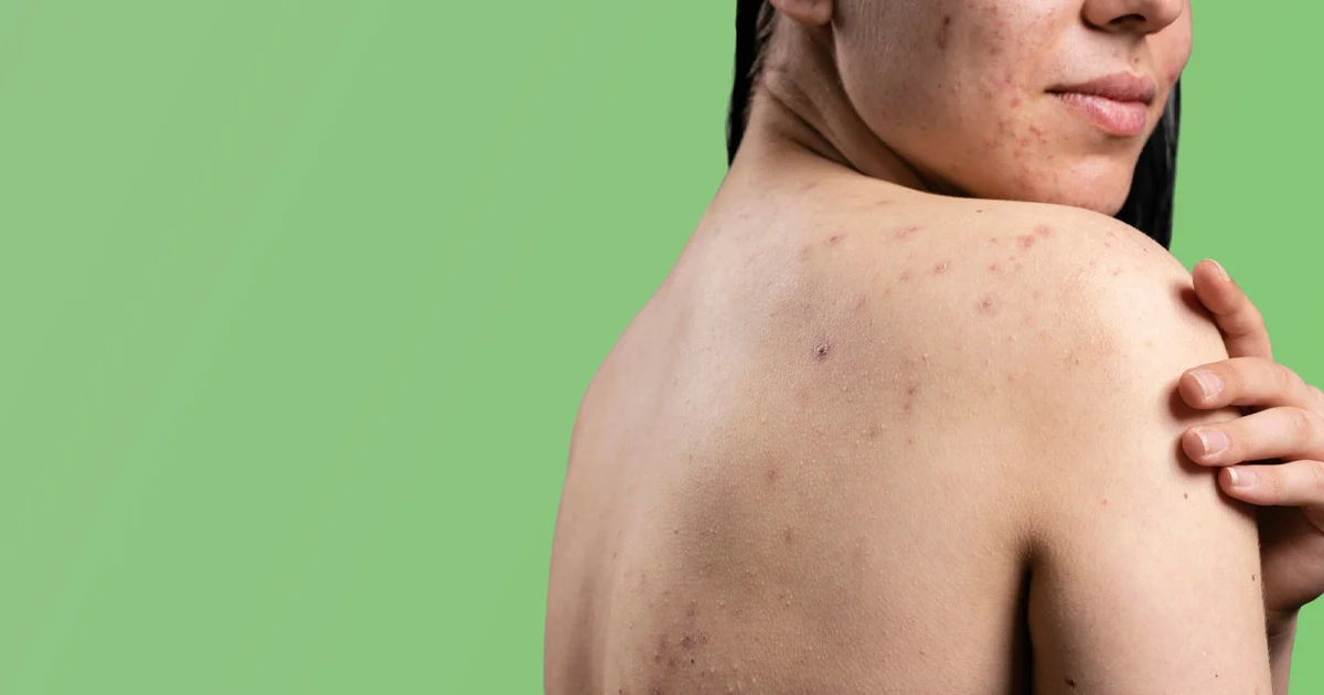 Le Biorythme de la Peau