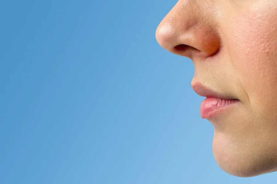 Hyperpigmentation des lèvres