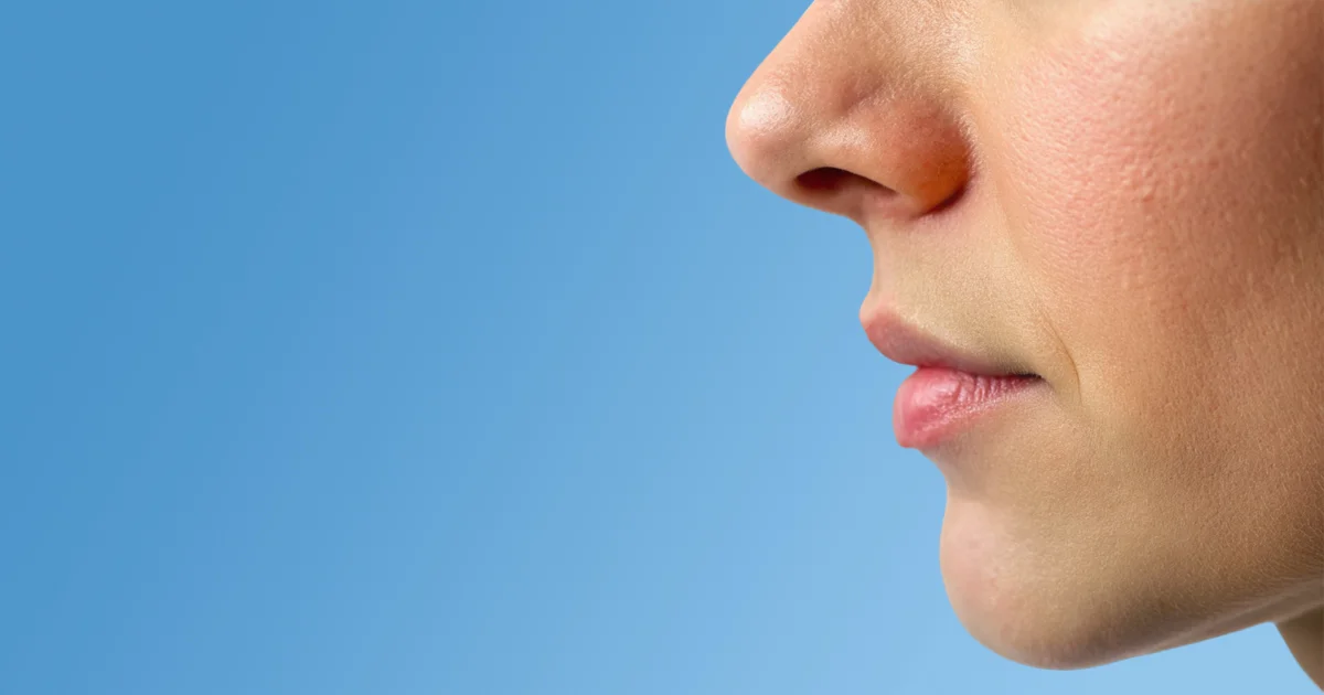 Hyperpigmentation des lèvres