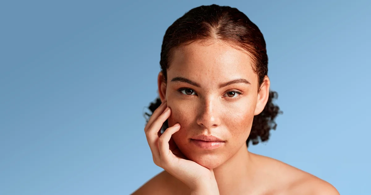 Taches brunes et peau terne : de l'hyperpigmentation à l'éclat