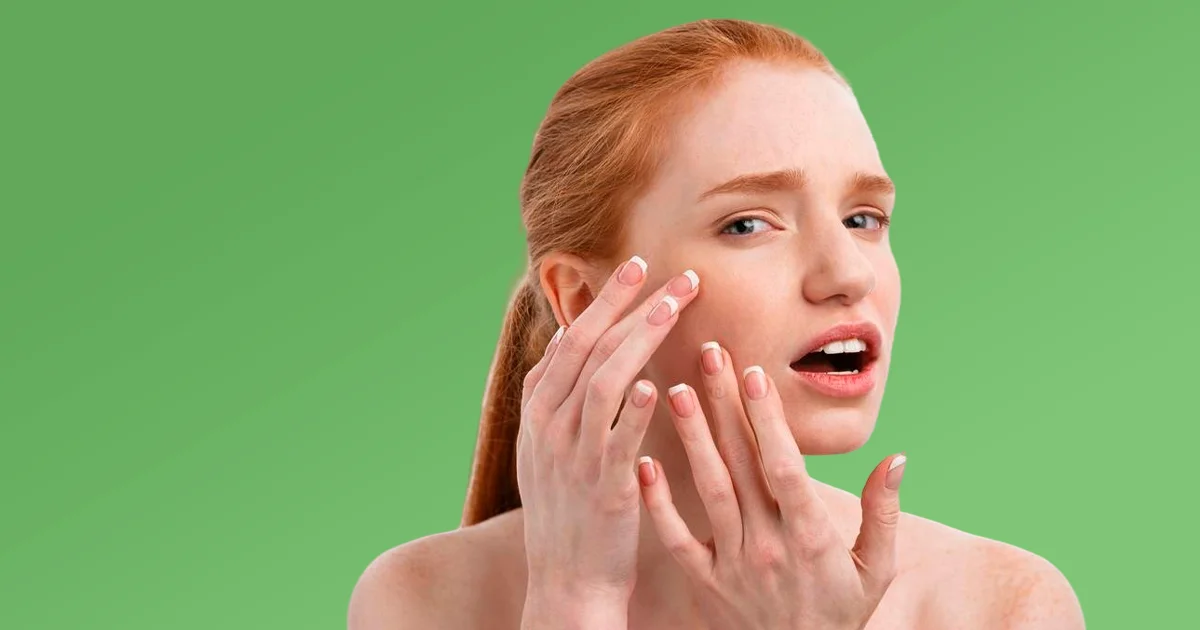 peau acnéique : les 8 erreurs à éviter